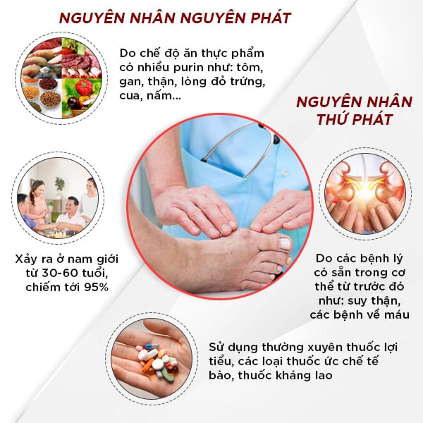 Tổng hợp các nguyên nhân gây bệnh gout: Có thể bắt nguồn từ chế độ ăn uống