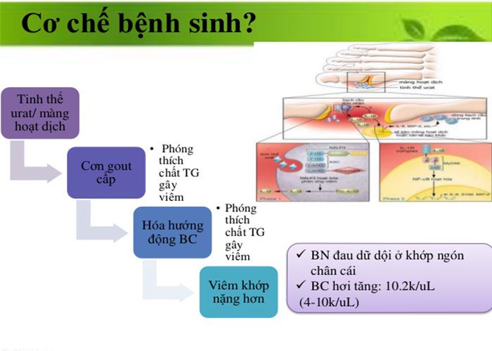 người gầy có bị gút không 