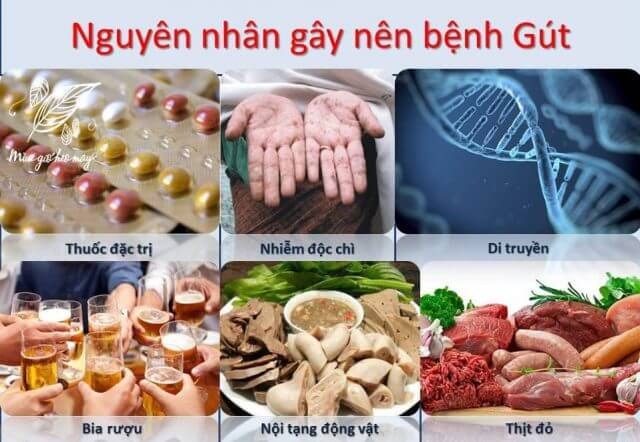 Bệnh gout ở nam giới và những điều không thể bỏ qua