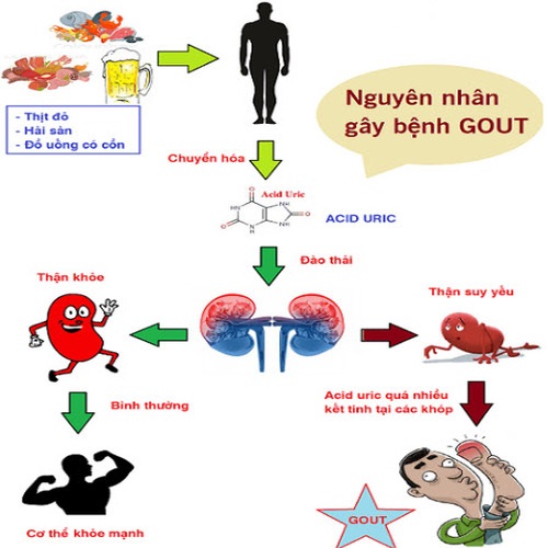 nguyên nhân làm tăng acid uric máu 