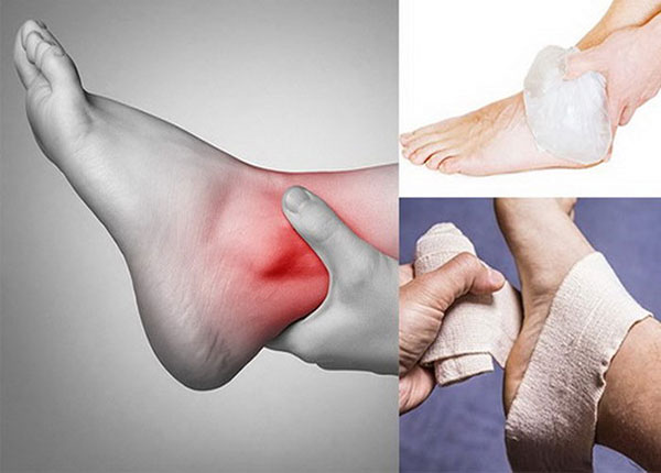 Bị gout sưng mắt cá chân