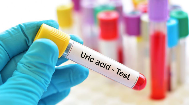 Acid uric cao có nguy hiểm không? 