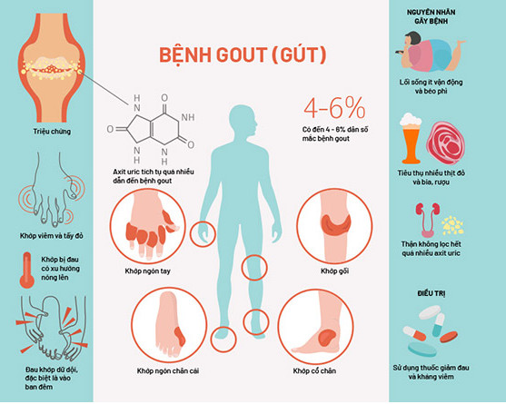 Dấu hiệu bệnh gout cấp