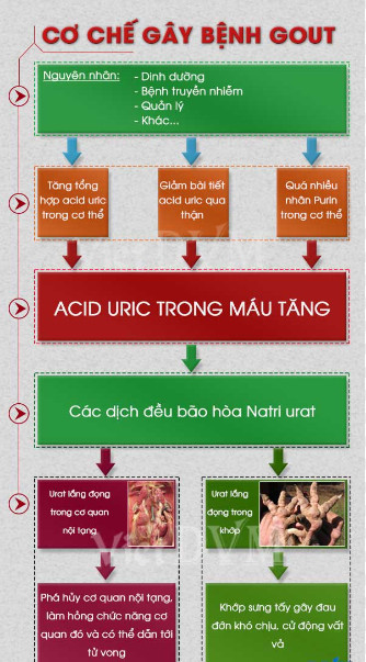 Cách điều trị dứt điểm bệnh gút