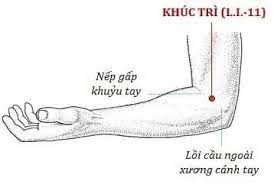 Điều trị gout bằng phương pháp châm cứu