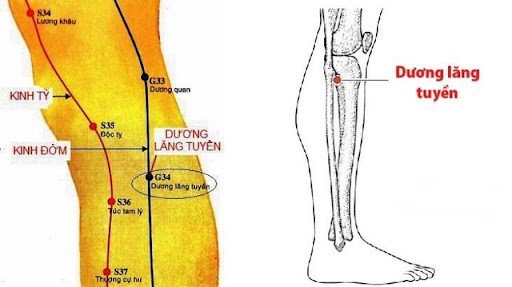 Điều trị gout bằng phương pháp châm cứu