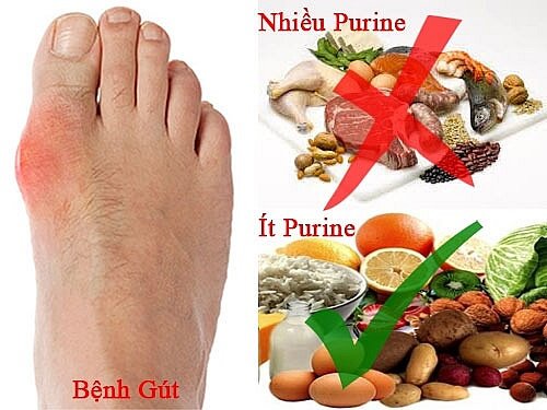 Thực phẩm cho người bệnh gout