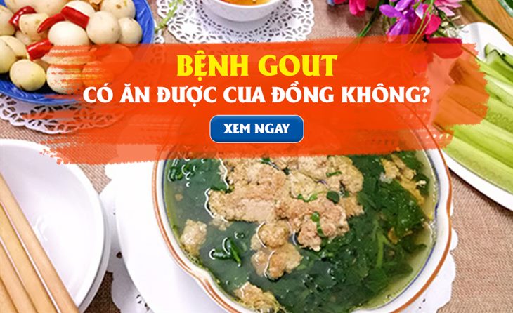 Bệnh gút có ăn được canh cua không? Người mắc gút nên ăn gì để giảm bớt đau, viêm, sưng khớp?  