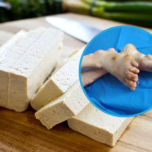 Bệnh gút có ăn được đậu phụ không? 