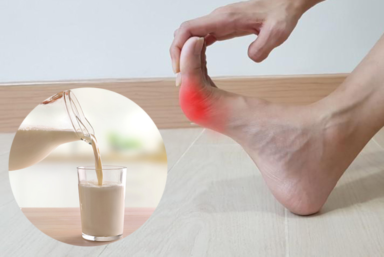 Người bị gout nên uống sữa gì? Lợi ích của uống sữa với người bị gout?