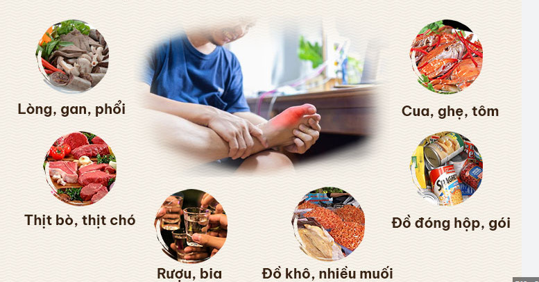 Vì sao bệnh gout thường gây đau vào ban đêm?