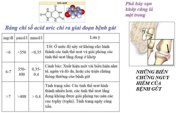 tăng acid uric máu là gì?