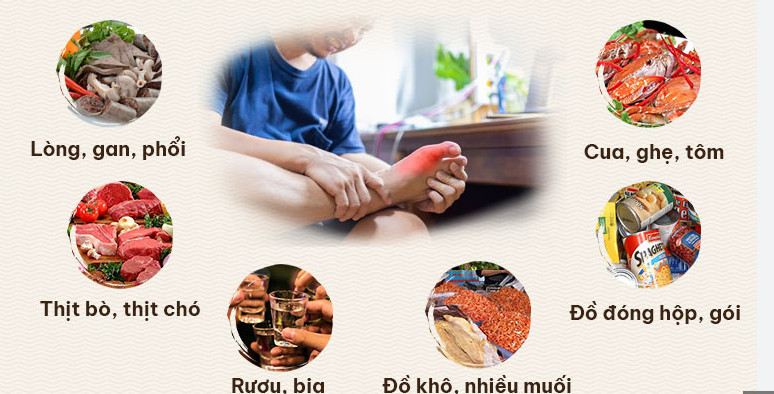 Bệnh gout có lây không? 