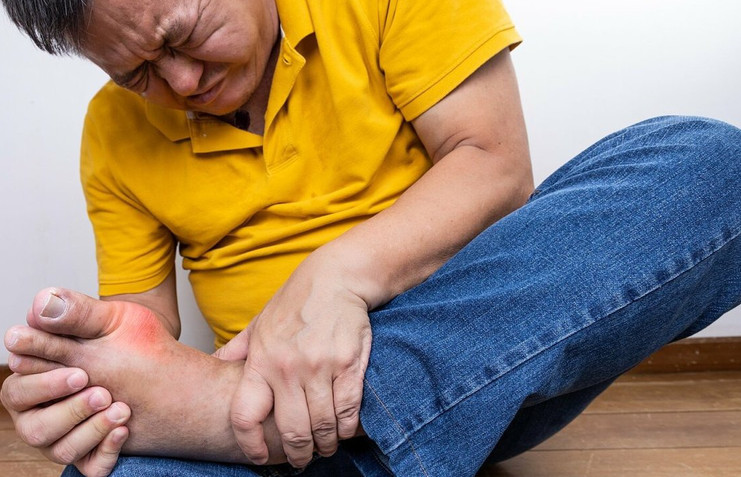 Bệnh gout có ảnh hưởng đến khả năng sinh sản không?