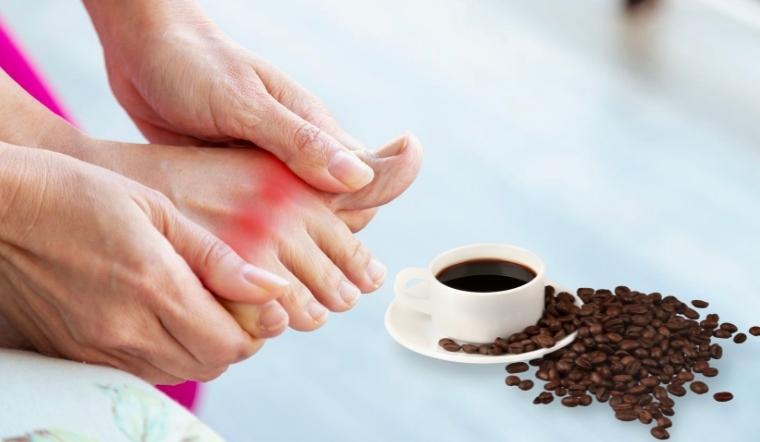  Bị gout có nên uống cafe không? Những loại đồ uống tuyệt vời dành cho người bị gout