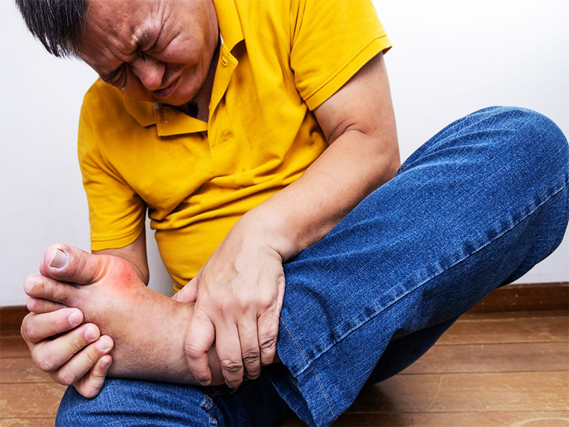 Đối tượng mắc bệnh gout