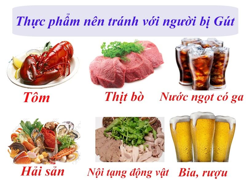 Uống Khang Thống Linh có phải kiêng khem gì không?